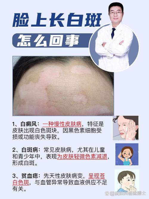 白斑的10种症状图,白斑是怎么引起的,该如何治疗呢?