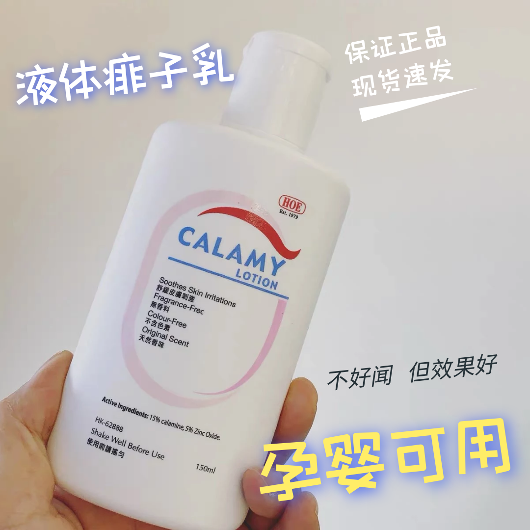 儿童去痱子止痒最有效的方法,儿童去痱子止痒最有效的方法图片
